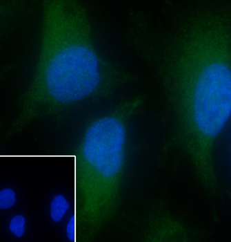 Annexin IV antibody