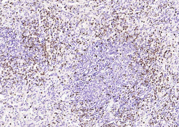 S100P antibody