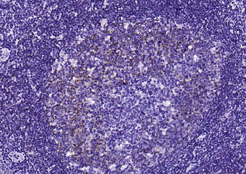 CD23 antibody