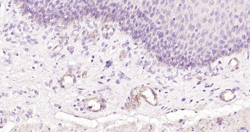 CD62p antibody