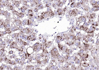 Catalase antibody