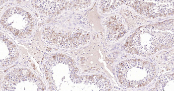 Inhibin alpha antibody