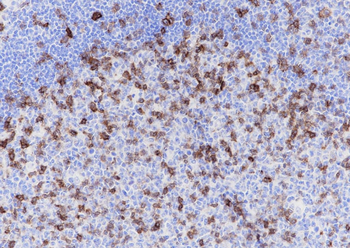 ICOS antibody