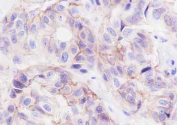 EphA2 antibody