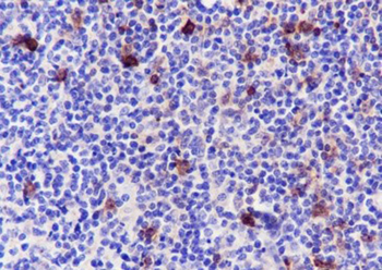 CD134 antibody