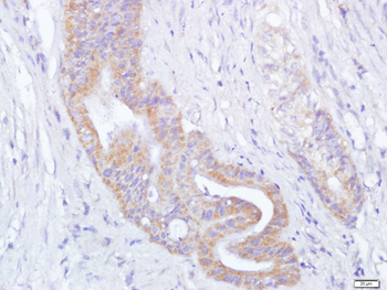 TRX antibody