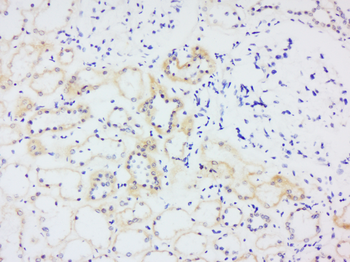 TRX antibody