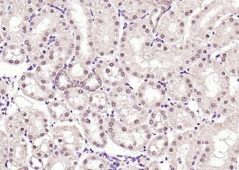 TRX antibody