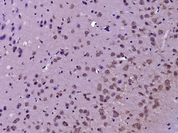 TYH antibody