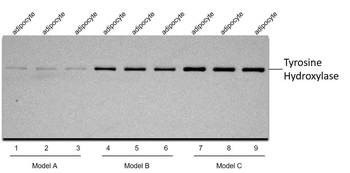 TYH antibody