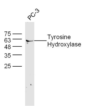 TYH antibody