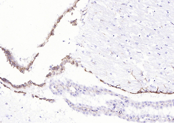 Vimentin antibody