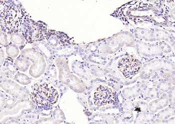 Vimentin antibody