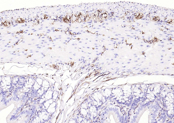 Vimentin antibody