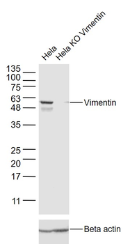 Vimentin antibody