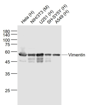 Vimentin antibody