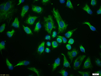 Vimentin antibody