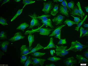 Vimentin antibody