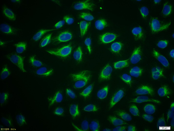 Vimentin antibody