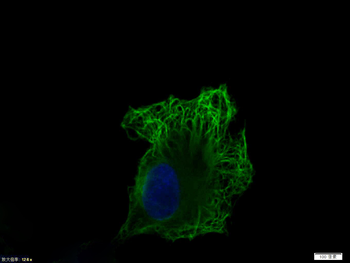 Vimentin antibody