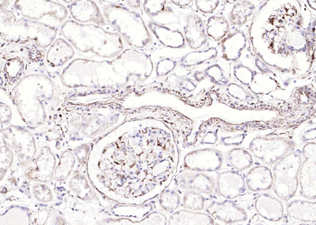 Vimentin antibody