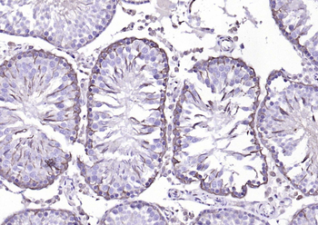 GAPDH antibody