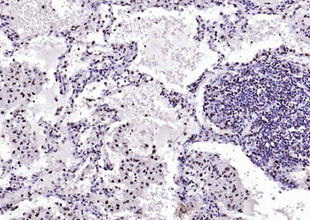 GAPDH antibody