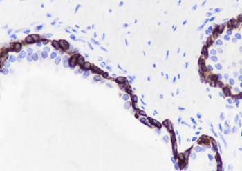 Keratin 15 antibody