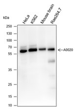 ELP3 antibody