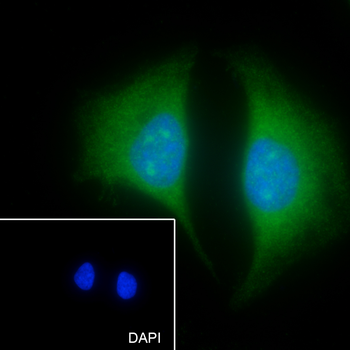 ELP3 antibody