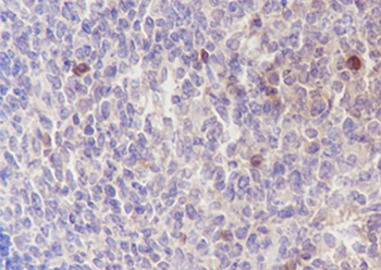 ELP3 antibody