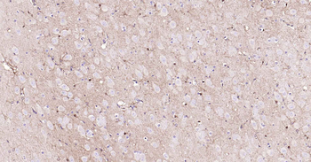 ALDH1L1 antibody