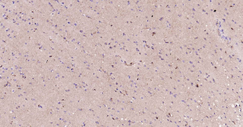 ALDH1L1 antibody