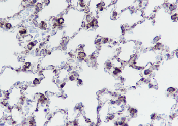 BCLG antibody