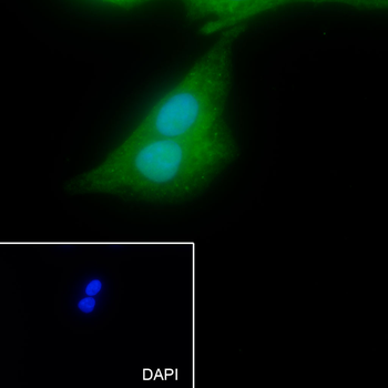 SBDS antibody