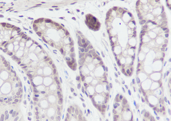 SBDS antibody