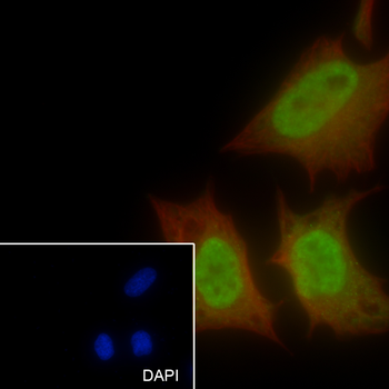 SF1 antibody