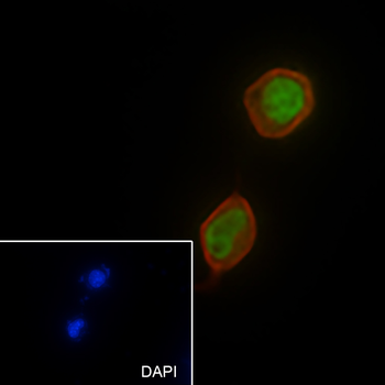 SF1 antibody