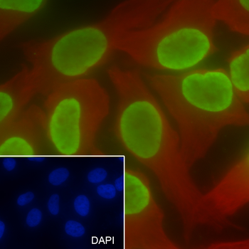 Di-Methyl-Histone H3 (Lys27) antibody