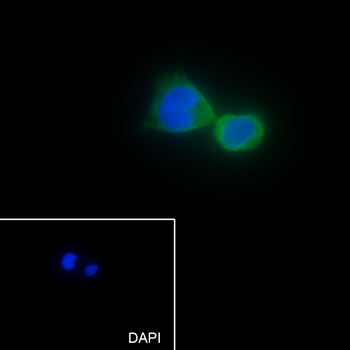 OGDH antibody