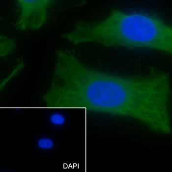 GPNMB antibody