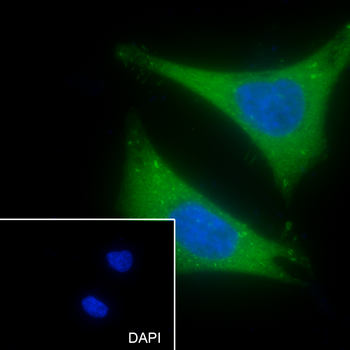 Luteinizing Hormone antibody