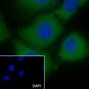 Luteinizing Hormone antibody