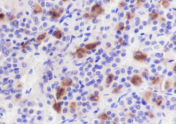 Luteinizing Hormone antibody