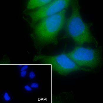 Keratin 14 antibody