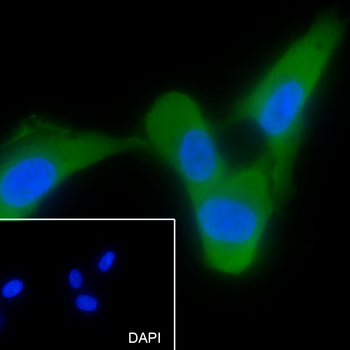 Keratin 14 antibody