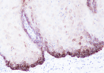 Keratin 14 antibody