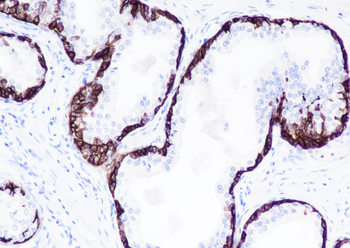 Keratin 14 antibody