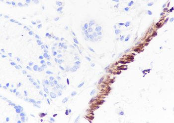 HSP20 antibody