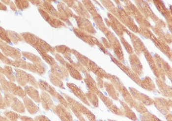 HSP20 antibody